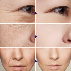 BREYLEE one Retinol Removedor de rugas anti envelhecimento com essência facial
