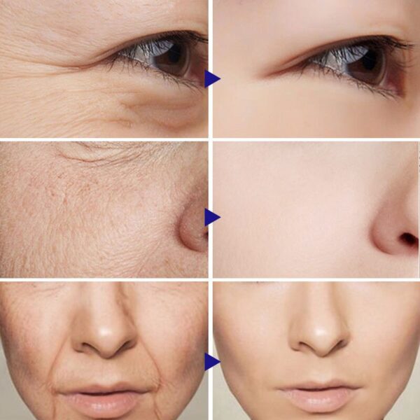 BREYLEE one Retinol Removedor de rugas anti envelhecimento com essência facial